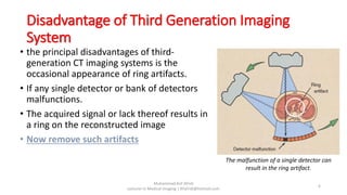 Disadvantage of Third Generation Imaging
System
• the principal disadvantages of third-
generation CT imaging systems is the
occasional appearance of ring artifacts.
• If any single detector or bank of detectors
malfunctions.
• The acquired signal or lack thereof results in
a ring on the reconstructed image
• Now remove such artifacts
Muhammad Arif Afridi
Lecturer in Medical Imaging | RFafridi@hotmail.com
6
The malfunction of a single detector can
result in the ring artifact.
 