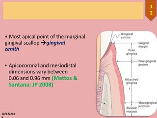 • Most apical point of the marginal
gingival scallop gingival
zenith
• Apicocoronal and mesiodistal
dimensions vary between
0.06 and 0.96 mm (Mattos &
Santana; JP 2008)
10/12/201
1
2
 