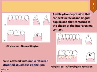 10/12/201
1
8
Gingival col : Normal Gingiva
Gingival col : After Gingival recession
A valley-like depression that
connects a facial and lingual
papilla and that conforms to
the shape of the interproximal
contact
col is covered with nonkeratinized
stratified squamous epithelium
 