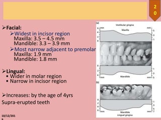 Facial:
Widest in incisor region
Maxilla: 3.5 – 4.5 mm
Mandible: 3.3 – 3.9 mm
Most narrow adjacent to premolar
Maxilla: 1.9 mm
Mandible: 1.8 mm
Lingual:
• Wider in molar region
• Narrow in incisor region
Increases: by the age of 4yrs
Supra-erupted teeth
10/12/201
2
0
 