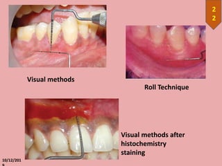 10/12/201
2
2
Visual methods
Roll Technique
Visual methods after
histochemistry
staining
 