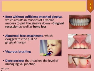 • Born without sufficient attached gingiva,
which results in muscles of alveolar
mucosa to pull the gingiva down - Gingival
recession as well as bone loss
• Abnormal free attachment, which
exaggerates the pull on
gingival margin
• Vigorous brushing
• Deep pockets that reaches the level of
mucogingival junction
10/12/201
2
8
 