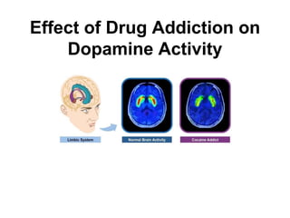 Effect of Drug Addiction on
Dopamine Activity
 