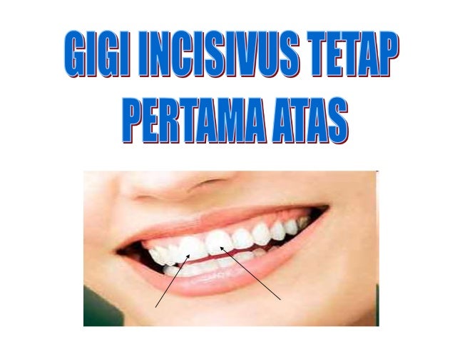 2 Dental Anatomi Gigi Permanen