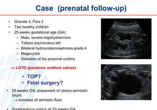 Case (prenatal follow-up)
•
•
•

Gravida 3, Para 2
Two healthy children
25 weeks gestational age (GA):
– Male, severe oligohydramnios
– Talipes equinovarus left
– Bilateral hydroureteronephrosis grade 4
– Megacystis
– Dilatation of the proximal urethra

 LUTO (posterior urethral valves)

• TOP?
• Fetal surgery?
• 25 weeks GA: placement of vesico-amniotic
shunt
 increase of amniotic fluid

 