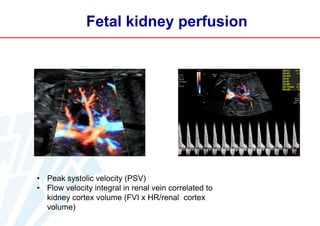 Fetal kidney perfusion

• Peak systolic velocity (PSV)
• Flow velocity integral in renal vein correlated to
kidney cortex volume (FVI x HR/renal cortex
volume)

 