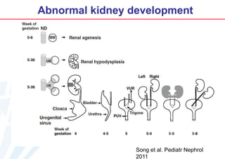 Abnormal kidney development

Song et al. Pediatr Nephrol
2011

 