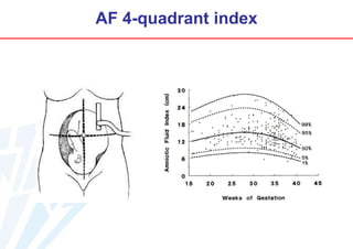 AF 4-quadrant index

 