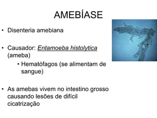 AMEBÍASE
• Disenteria amebiana
• Causador: Entamoeba histolytica
(ameba)
• Hematófagos (se alimentam de
sangue)
• As amebas vivem no intestino grosso
causando lesões de difícil
cicatrização
 
