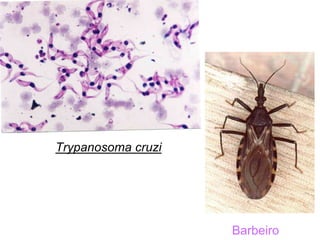Trypanosoma cruzi
Barbeiro
 
