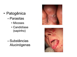• Patogênica
–Parasitas
• Micoses
• Candidíase
(sapinho)
–Substâncias
Alucinógenas
 