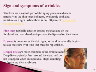 49
Sign and symptoms of wrinkles
Wrinkles are a natural part of the aging process and occur
naturally as the skin loses collagen, hyaluronic acid, and
moisture as it ages. While there is no 100 percent cure to stop
the aging process
Fine lines typically develop around the eyes and on the
forehead, and can also develop above the lips and on the cheeks.
Dryness is common as the skin ages, as the skin naturally begins
to lose moisture over time that must be replenished.
Deeper lines are more common in the twenties and thirties.
Deep lines typically form around the eyes, and do
not disappear when an individual stops squinting
or furrowing their eyebrows.
 