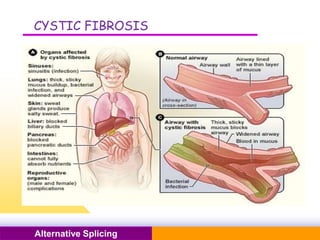 Pacific Networks Pacific NetworksAlternative Splicing
CYSTIC FIBROSIS
 