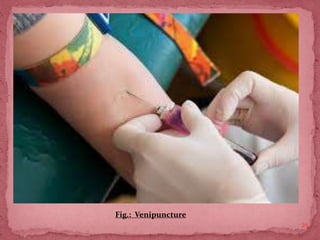 25
Fig.: Venipuncture
 