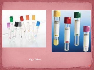 28
Fig.: Tubes
 