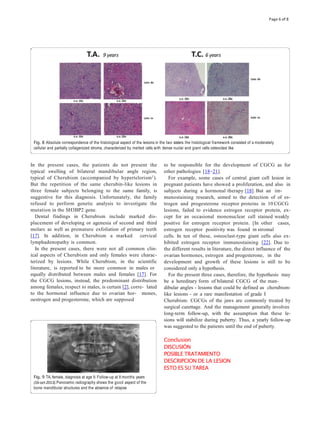 In the present cases, the patients do not present the
typical swelling of bilateral mandibular angle region,
typical of Cherubism (accompanied by hypertelorism1).
But the repetition of the same cherubin-like lesions in
three female subjects belonging to the same family, is
suggestive for this diagnosis. Unfortunately, the family
refused to perform genetic analysis to investigate the
mutation in the SH3BP2 gene.
Dental findings in Cherubism include marked dis-
placement of developing or agenesia of second and third
molars as well as premature exfoliation of primary teeth
[17]. In addition, in Cherubism a marked cervical
lymphadenopathy is common.
In the present cases, there were not all common clin-
ical aspects of Cherubism and only females were charac-
terized by lesions. While Cherubism, in the scientific
literature, is reported to be more common in males or
equally distributed between males and females [17]. For
the CGCG lesions, instead, the predominant distribution
among females, respect to males, is certain [2], corre- lated
to the hormonal influence due to ovarian hor- mones,
oestrogen and progesterone, which are supposed
to be responsible for the development of CGCG as for
other pathologies [18–21].
For example, some cases of central giant cell lesion in
pregnant patients have showed a proliferation, and also in
subjects during a hormonal therapy [18]. But an im-
munostaining research, aimed to the detection of of es-
trogen and progesterone receptor proteins in 10 CGCG
lesions, failed to evidence estrogen receptor protein, ex-
cept for an occasional mononuclear cell stained weakly
positive for estrogen receptor protein. [In other cases,
estrogen receptor positivity was found in stromal
cells. In ten of these, osteoclast-type giant cells also ex-
hibited estrogen receptor immunostaining [22]. Due to
the different results in literature, the direct influence of the
ovarian hormones, estrogen and progesterone, in the
development and growth of these lesions is still to be
considered only a hypothesis.
For the present three cases, therefore, the hypothesis may
be a hereditary form of bilateral CGCG of the man-
dibular angles - lesions that could be defined as cherubism-
like lesions - or a rare manifestation of grade I
Cherubism. CGCGs of the jaws are commonly treated by
surgical curettage. And the management generally involves
long-term follow-up, with the assumption that these le-
sions will stabilize during puberty. Thus, a yearly follow-up
was suggested to the patients until the end of puberty.
Conclusion
DISCUSIÓN
POSIBLE TRATAMIENTO
DESCRIPCION DE LA LESION
ESTO ES SU TAREA
Fig. 8 Absolute correspondence of the histological aspect of the lesions in the two sisters: the histological framework consisted of a moderately
cellular and partially collagenized stroma, characterized by melted cells with dense nuclei and giant cells osteoclast like
Fig. 9 TA, female, diagnosis at age 9. Follow-up at 8 months years
(16-oct-2013).Panoramic radiography shows the good aspect of the
bone mandibular structures and the absence of relapse
Page 6 of 8
 