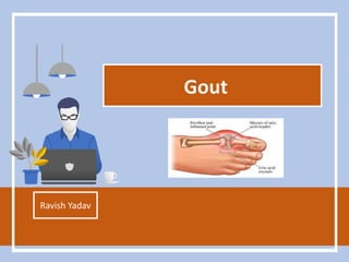 Gout
Ravish Yadav
 