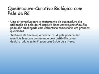 Queimadura-Curativo Biológico com
Pele de Rã
• Uma alternativa para o tratamento de queimadura é a
utilização da pele de rã espécie Rana catesbiana shaw.Ela
pode ser empregada com cobertura temporária em grandes
queimados
• Trata-se de tecnologia brasileira. A pele poderá ser
mantida fresca e conservada com antibióticos ou
desidratada e esterilizada com óxido de etileno.
 