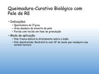 Queimadura-Curativo Biológico com
Pele de Rã
• Indicações:
• Queimadura de 2°grau
• Área doadora de enxerto de pele
• Ferida com tecido em fase de granulação
• Modo de aplicação:
• Pele fresca:Aplicá-la diretamente sobre a lesão
• Pele desidratada: Reidratá-la com SF de modo que readquira sua
normal textura
 