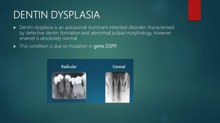 DENTIN DYSPLASIA
 Dentin dysplasia is an autosomal dominant inherited disorder characterised
by defective dentin formation and abnormal pulpal morphology, however
enamel is absolutely normal.
 This condition is due to mutation in gene DSPP.
 