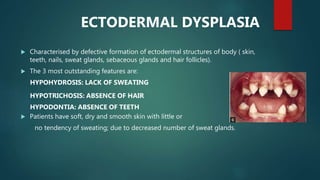 ECTODERMAL DYSPLASIA
 Characterised by defective formation of ectodermal structures of body ( skin,
teeth, nails, sweat glands, sebaceous glands and hair follicles).
 The 3 most outstanding features are:
HYPOHYDROSIS: LACK OF SWEATING
HYPOTRICHOSIS: ABSENCE OF HAIR
HYPODONTIA: ABSENCE OF TEETH
 Patients have soft, dry and smooth skin with little or
no tendency of sweating; due to decreased number of sweat glands.
 