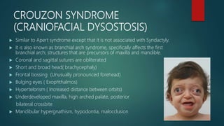 CROUZON SYNDROME
(CRANIOFACIAL DYSOSTOSIS)
 Similar to Apert syndrome except that it is not associated with Syndactyly.
 It is also known as branchial arch syndrome, specifically affects the first
branchial arch; structures that are precursors of maxilla and mandible.
 Coronal and sagittal sutures are obliterated
 Short and broad head( brachycephaly)
 Frontal bossing (Unusually pronounced forehead)
 Bulging eyes ( Exophthalmos)
 Hypertelorism ( Increased distance between orbits)
 Underdeveloped maxilla, high arched palate, posterior
bilateral crossbite
 Mandibular hypergnathism, hypodontia, malocclusion
 