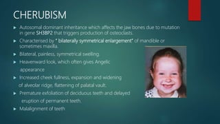 CHERUBISM
 Autosomal dominant inheritance which affects the jaw bones due to mutation
in gene SH3BP2 that triggers production of osteoclasts.
 Characterised by “ bilaterally symmetrical enlargement” of mandible or
sometimes maxilla.
 Bilateral, painless, symmetrical swelling.
 Heavenward look, which often gives Angelic
appearance
 Increased cheek fullness, expansion and widening
of alveolar ridge, flattening of palatal vault.
 Premature exfoliation of deciduous teeth and delayed
eruption of permanent teeth.
 Malalignment of teeth
 