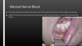 Mental Nerve Block
■ Premolars anteriorly as well as the soft tissues of the lower lip and chin to the midline on one side.
■ Depth of the buccal sulcus between the premolar teeth and advanced to a zone below the premolar
apices.
 