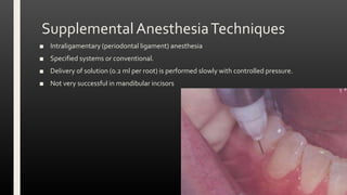 SupplementalAnesthesiaTechniques
■ Intraligamentary (periodontal ligament) anesthesia
■ Specified systems or conventional.
■ Delivery of solution (0.2 ml per root) is performed slowly with controlled pressure.
■ Not very successful in mandibular incisors
 