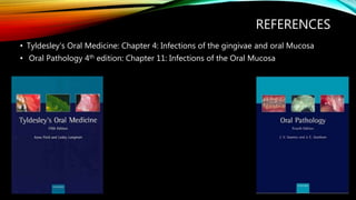 Bacterial Infections of Oral Mucosa | PPTX