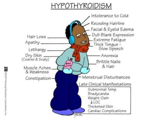 CLINICAL FEATURES
Hypothyroidism can be presented in many
different ways and can mimic other disorders
Because many manifestations of
hypothyroidism
are non-specific,
the diagnosis is particularly likely to be
overlooked
in patients with other chronic illnesses and
elderly
and can lead to significant morbidity and even
mortality
 