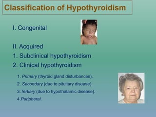 Classification of Hypothyroidism
I. Congenital
II. Acquired
1. Subclinical hypothyroidism
2. Clinical hypothyroidism
1. Primary (thyroid gland disturbances).
2. Secondary (due to pituitary disease).
3.Tertiary (due to hypothalamic disease).
4.Peripheral.
 