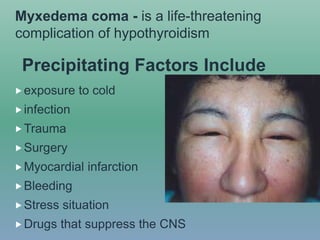 Precipitating Factors Include
exposure to cold
infection
Trauma
Surgery
Myocardial infarction
Bleeding
Stress situation
Drugs that suppress the CNS
Myxedema coma - is a life-threatening
complication of hypothyroidism
 