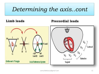 Determining the axis..cont
Limb leads Precordial leads
samueldebassu@gmail.com 12
 