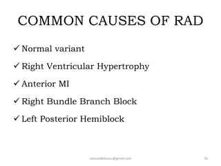 COMMON CAUSES OF RAD
 Normal variant
 Right Ventricular Hypertrophy
 Anterior MI
 Right Bundle Branch Block
 Left Posterior Hemiblock
samueldebassu@gmail.com 16
 
