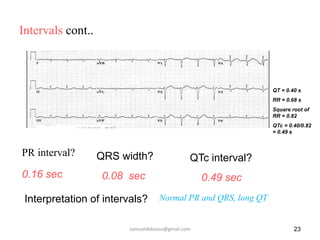 Intervals cont..
23
PR interval? QRS width? QTc interval?
0.08 sec
0.16 sec 0.49 sec
QT = 0.40 s
RR = 0.68 s
Square root of
RR = 0.82
QTc = 0.40/0.82
= 0.49 s
Interpretation of intervals? Normal PR and QRS, long QT
samueldebassu@gmail.com
 