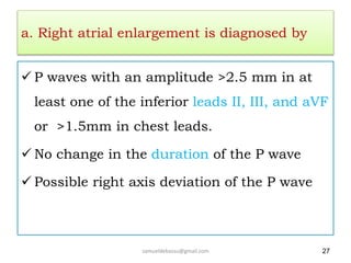 a. Right atrial enlargement is diagnosed by
 P waves with an amplitude >2.5 mm in at
least one of the inferior leads II, III, and aVF
or >1.5mm in chest leads.
 No change in the duration of the P wave
 Possible right axis deviation of the P wave
samueldebassu@gmail.com 27
 