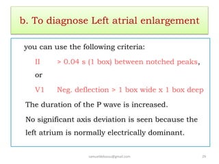 b. To diagnose Left atrial enlargement
you can use the following criteria:
II > 0.04 s (1 box) between notched peaks,
or
V1 Neg. deflection > 1 box wide x 1 box deep
The duration of the P wave is increased.
No significant axis deviation is seen because the
left atrium is normally electrically dominant.
samueldebassu@gmail.com 29
 