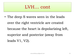 LVH… cont
• The deep S waves seen in the leads
over the right ventricle are created
because the heart is depolarizing left,
superior and posterior (away from
leads V1, V2).
samueldebassu@gmail.com 35
 