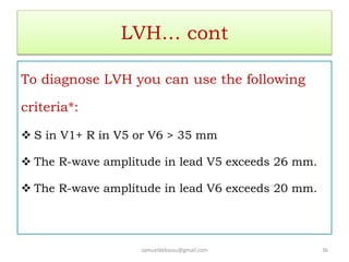 LVH… cont
To diagnose LVH you can use the following
criteria*:
 S in V1+ R in V5 or V6 > 35 mm
 The R-wave amplitude in lead V5 exceeds 26 mm.
 The R-wave amplitude in lead V6 exceeds 20 mm.
samueldebassu@gmail.com 36
 