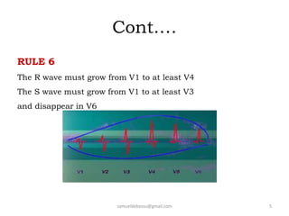 Cont.…
RULE 6
The R wave must grow from V1 to at least V4
The S wave must grow from V1 to at least V3
and disappear in V6
samueldebassu@gmail.com 5
 
