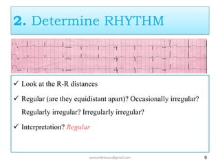 2. Determine RHYTHM
 Look at the R-R distances
 Regular (are they equidistant apart)? Occasionally irregular?
Regularly irregular? Irregularly irregular?
 Interpretation? Regular
9
samueldebassu@gmail.com
 
