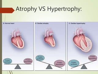 Atrophy VS Hypertrophy:
 