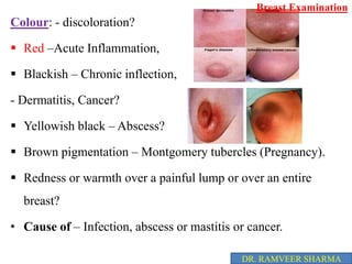 2. breast examination, Manual examination, Stana pareeksha, Self ...