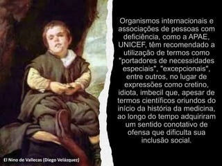 El Nino de Vallecas (Diego Velázquez)
 