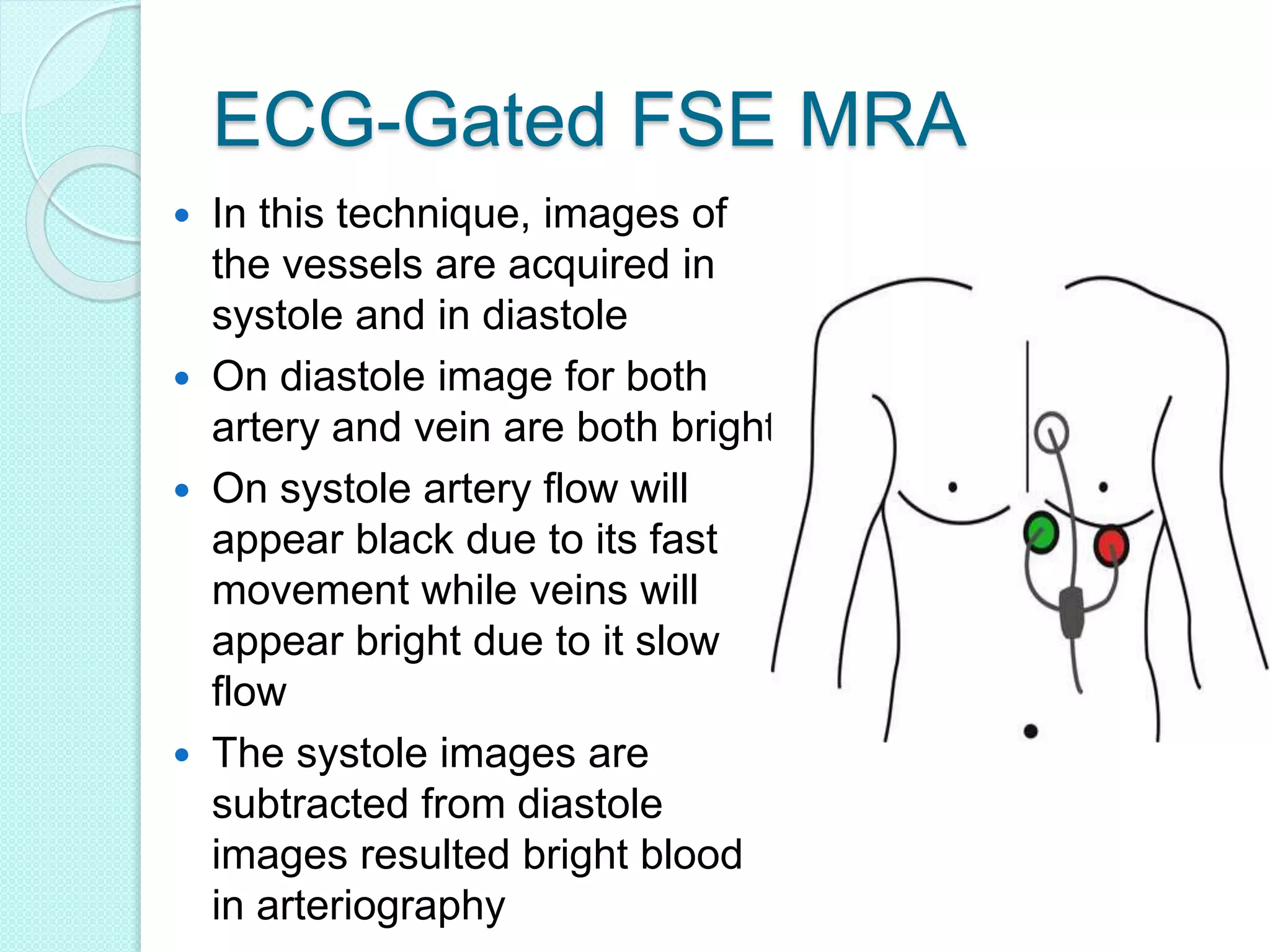 ECG-Gated FSE MRA
 In this technique, images of
the vessels are acquired in
systole and in diastole
 On diastole image for both
artery and vein are both bright
 On systole artery flow will
appear black due to its fast
movement while veins will
appear bright due to it slow
flow
 The systole images are
subtracted from diastole
images resulted bright blood
in arteriography
 
