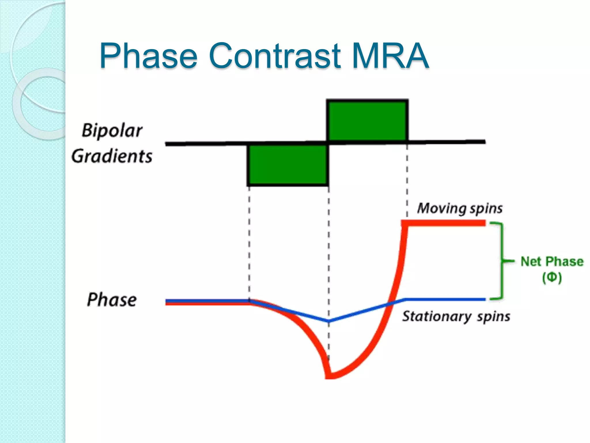 Phase Contrast MRA
 