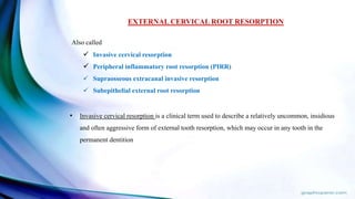 EXTERNAL CERVICAL ROOT RESORPTION
Also called
 Invasive cervical resorption
 Peripheral inflammatory root resorption (PIRR)
 Supraosseous extracanal invasive resorption
 Subepithelial external root resorption
• Invasive cervical resorption is a clinical term used to describe a relatively uncommon, insidious
and often aggressive form of external tooth resorption, which may occur in any tooth in the
permanent dentition
 