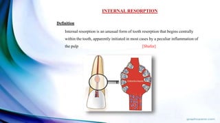 INTERNAL RESORPTION
Definition
Internal resorption is an unusual form of tooth resorption that begins centrally
within the tooth, apparently initiated in most cases by a peculiar inflammation of
the pulp [Shafer]
 
