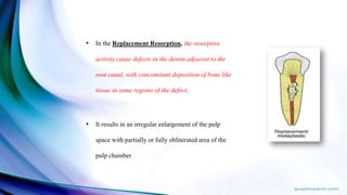 • In the Replacement Resorption, the resorptive
activity cause defects in the dentin adjacent to the
root canal, with concomitant deposition of bone like
tissue in some regions of the defect.
• It results in an irregular enlargement of the pulp
space with partially or fully obliterated area of the
pulp chamber
 